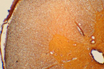 Нерв (поперечный срез) под микроскопом, 150x