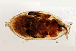 Мутация дрозофилы (бескрылая форма) под микроскопом, 60x. Мозаичное изображение.