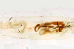 Мутация дрозофилы (черное тело) под микроскопом, 60x. Мозаичное изображение. 