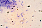 Сперматозоиды млекопитающего под микроскопом, 600x