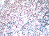 Moss Antheridia L.S. Антеридия мха (продольный срез) №28.