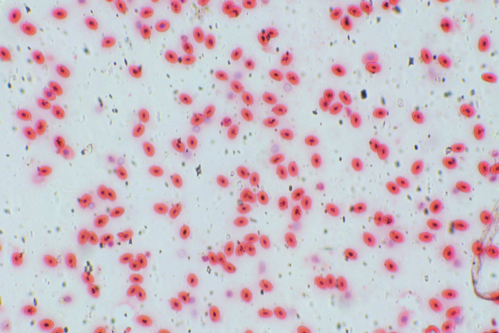 лейкоциты под микроскопом, лейкоциты под микроскопом фото, лейкоциты в моче под микроскопом, как выглядит лейкоциты под микроскопом