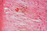Гиалиновый хрящ под микроскопом, 150x