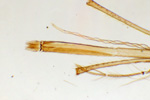 Ротовой аппарат комара под микроскопом, 60x