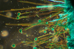 Плесень мукор (темное поле) под микроскопом, 150x