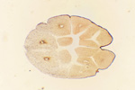 Дробление яйцеклетки под микроскопом, 60x