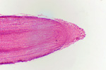 Корневой чехлик под микроскопом, 60x