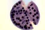 Вольвокс под микроскопом, 150x