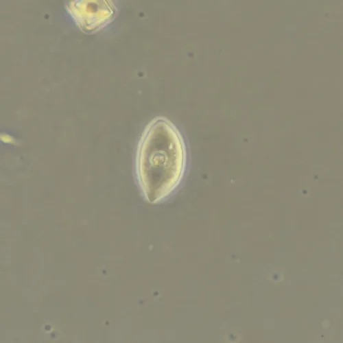 Фазово-контрастное устройство MAGUS SPH360 с набором объективов План ПолуАпохромат Plan S-Apo Ph 4х/10х/20х/40х/60х H60 мм,  18