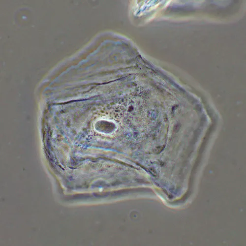 Фазово-контрастное устройство MAGUS SPH2,  16